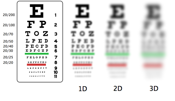 A vision chart used to screen vision