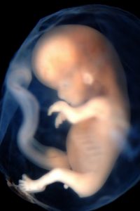 A human fetus.