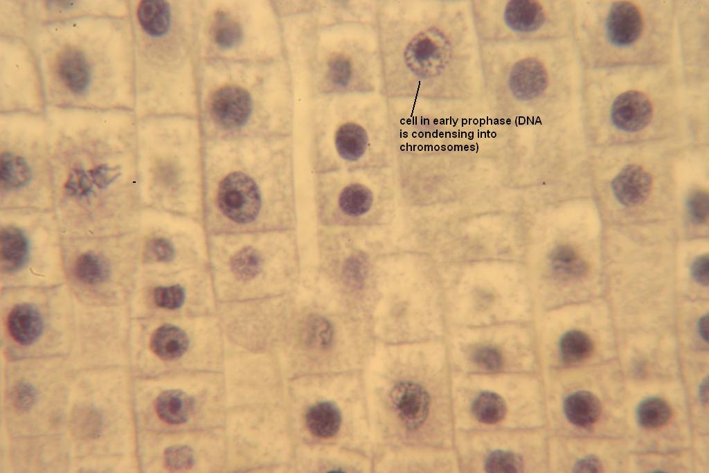 Митоз в корешке лука