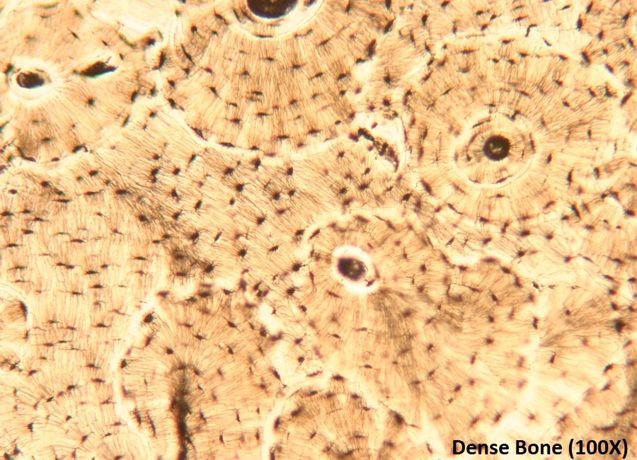 Bone Tissue – Tutorial – Histology Atlas for Anatomy and Physiology
