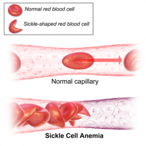 Healthy red blood cells are round/oval and sickle cells are sickle shaped (like a C)