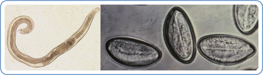 pinworm and pinworm eggs